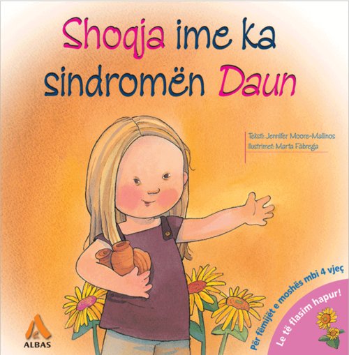 Shoqja ime ka sindromën Daun